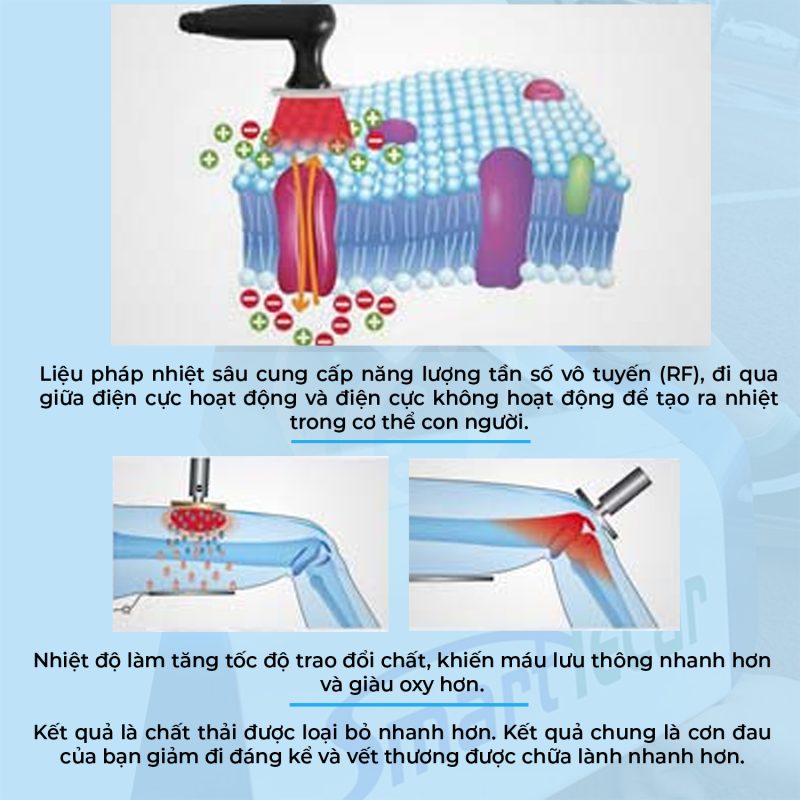 Máy Trị Liệu Bằng Sóng Vô Tuyến Smart Tecar